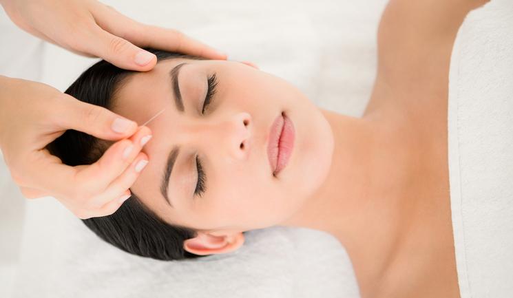 Τεχνική Needle Shaping